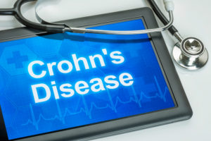 Crohn's Disease in Pediatric Patients